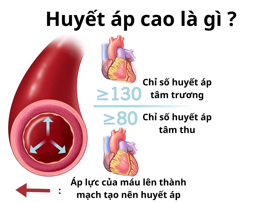 Người cao huyết áp có dùng ngựa thái được không 1