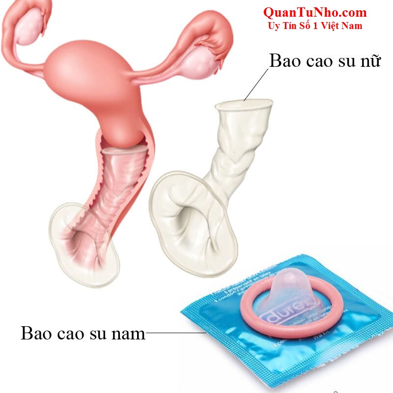 So sánh bao cao su cho nữ và bao cao su nam