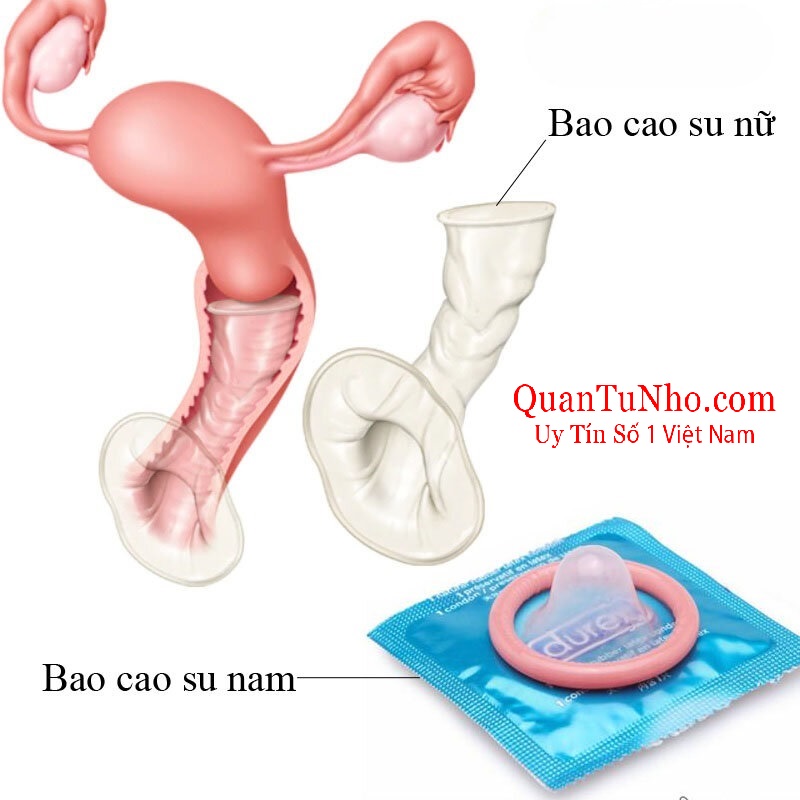 Sự khác biệt giữa bao cao su nam và bao cao su nữ