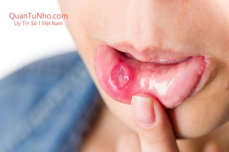 bú lồn có nguy cơ mắc các bệnh về đường tình dục