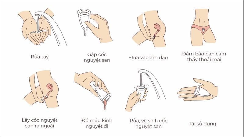 Cách Sử Dụng Cốc Nguyệt San Khi Đã Đặt Vòng