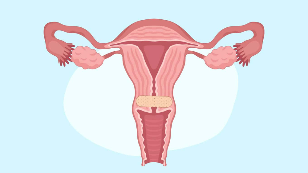 Cervical Changes