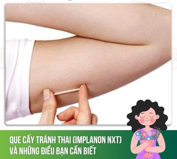 sau khi cấy que tránh thai cần kiêng gì