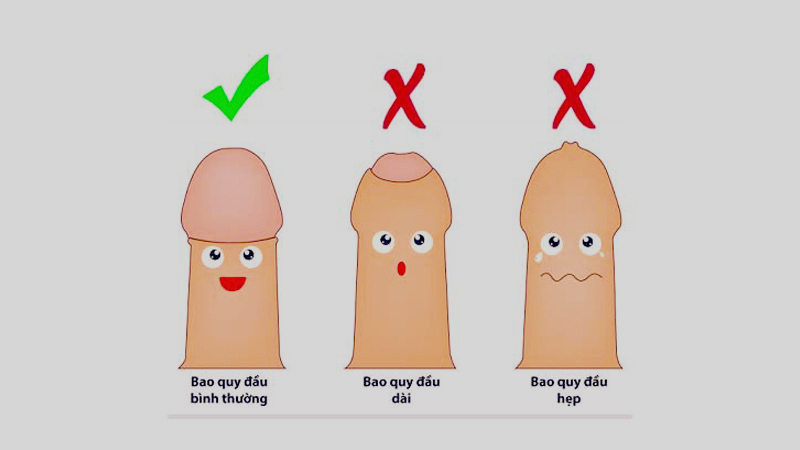 Hẹp bao quy đầu