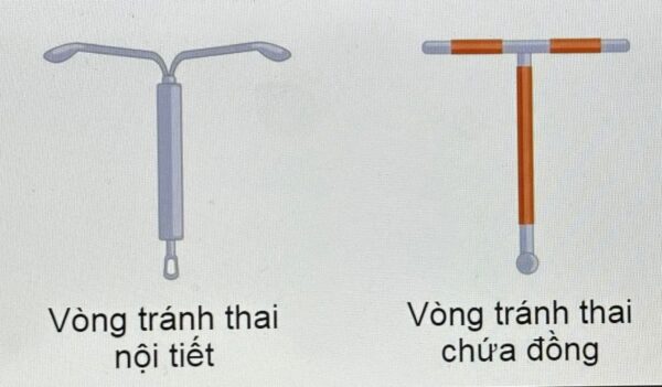 Đặt Vòng Tránh Thai Gồm Những Loại