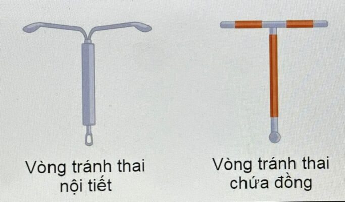 Đặt Vòng Tránh Thai Gồm Những Loại