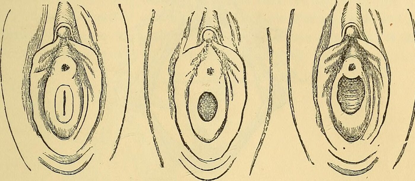 carunculae myrtiformes