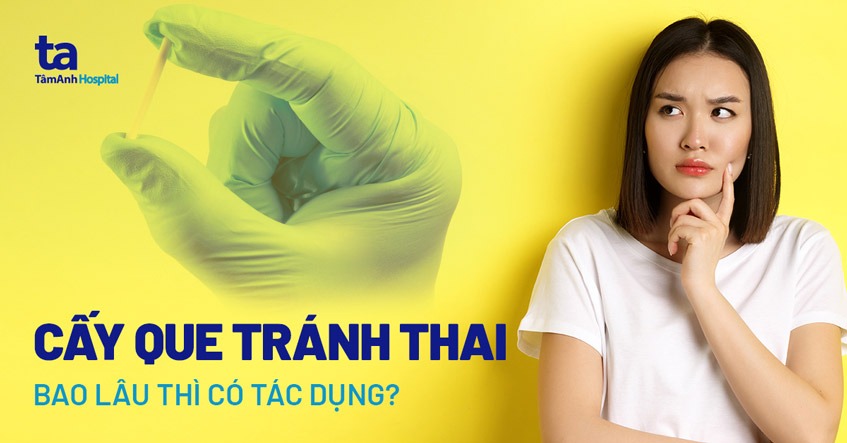 Sau Khi Cấy Que Tránh Thai Cần Kiêng Gì