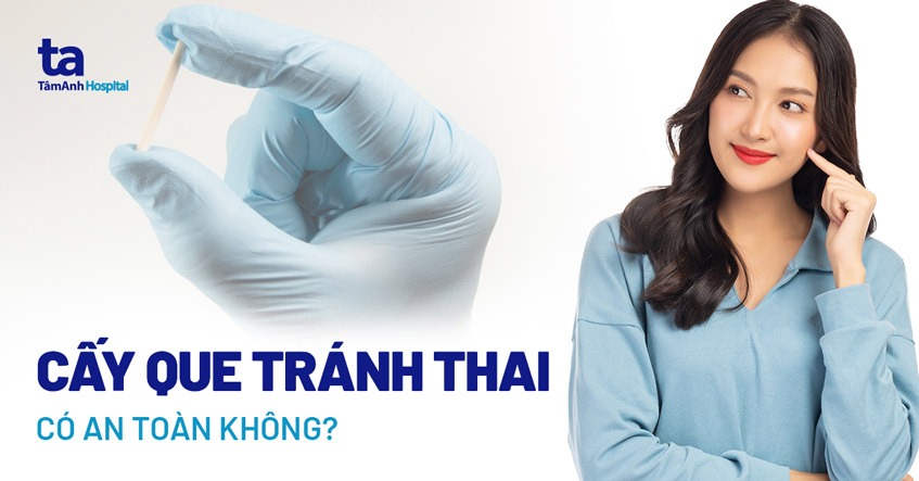 sau khi cấy que tránh thai cần kiêng gì