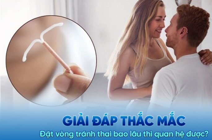 đặt vòng tránh thai kiêng quan hệ bao lâu