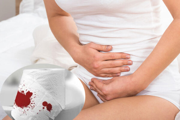 chảy máu bất thường, đau bụng dữ dội