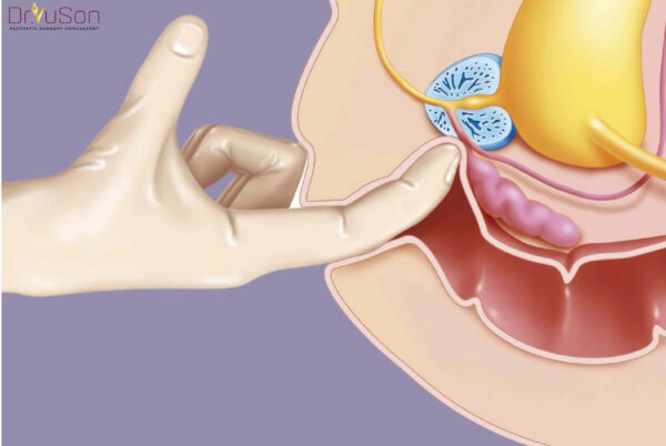 điểm G của đàn ông