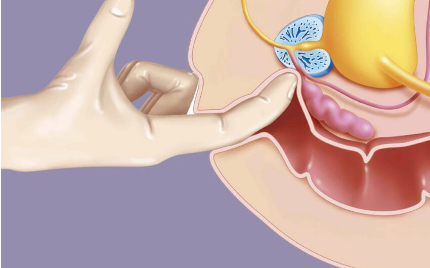 Điểm G của nam giới: Thông tin, Vị trí giải phẫu, Chức năng và Phương pháp kích thích 4 điểm G của đàn ông