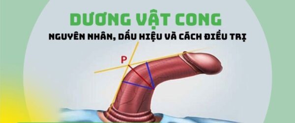 dương vật cong