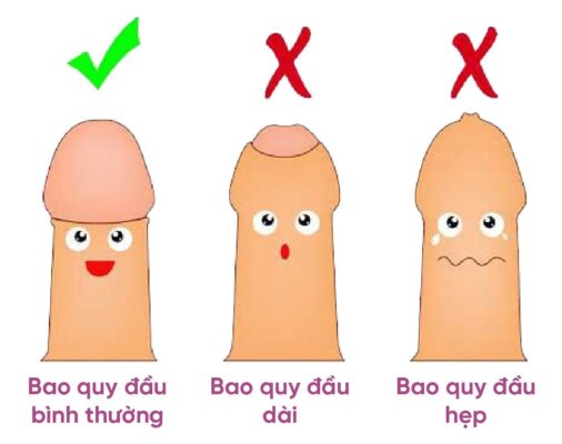 Bao quy đầu