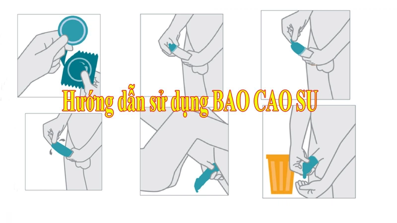 huong dan mang bao cao su 1
