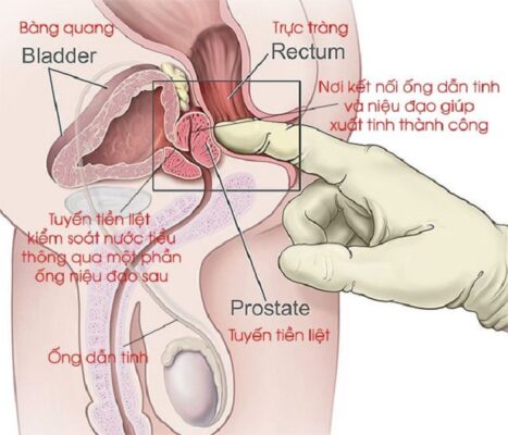 Kích thích điểm G đàn ông
