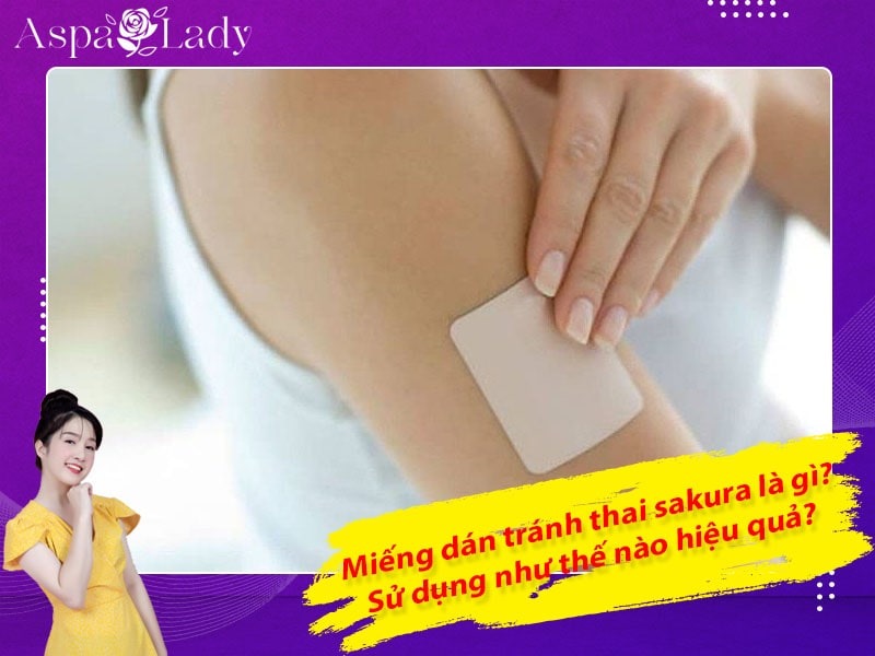 Mua Biện Pháp Tránh Thai Sakura Ở Đâu?