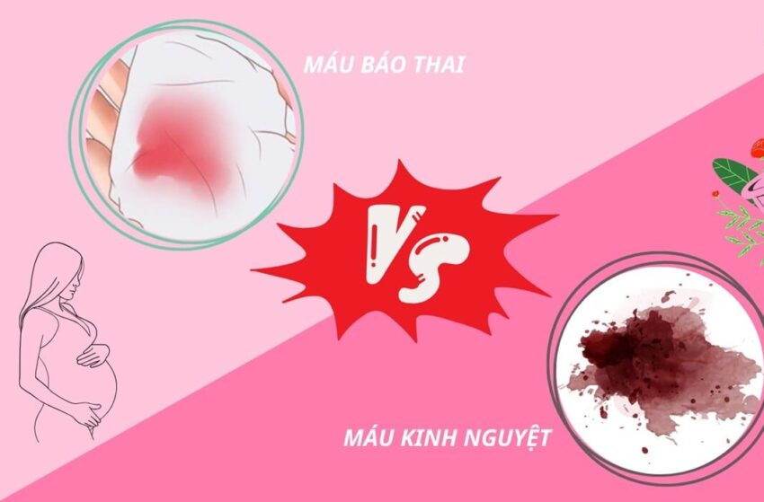 phan biet mau kinh nguyet va mau bao thai 1 e1758512605617