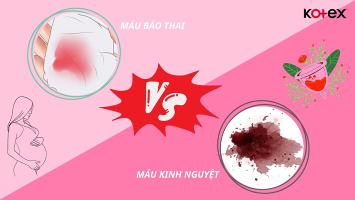Phân biệt máu kinh nguyệt và máu báo thai