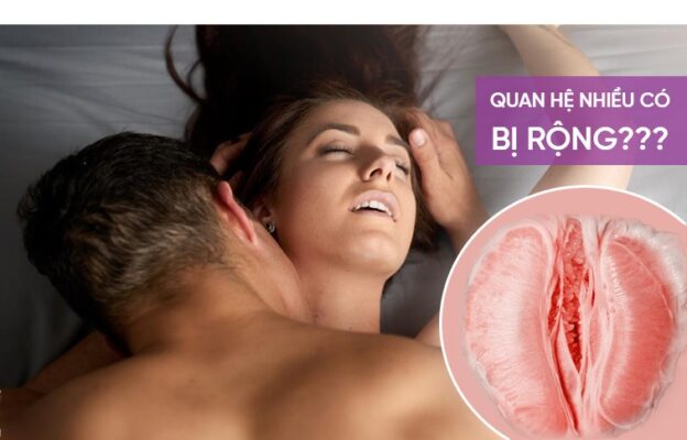 quan hệ nhiều có bị rộng không