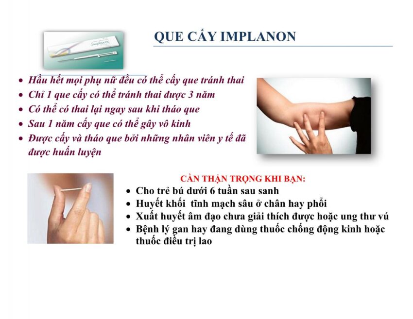 cấy que tránh thai vẫn có kinh nguyệt