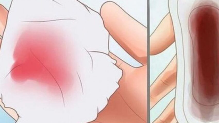 uống thuốc tránh thai hàng ngày bị ra máu nâu