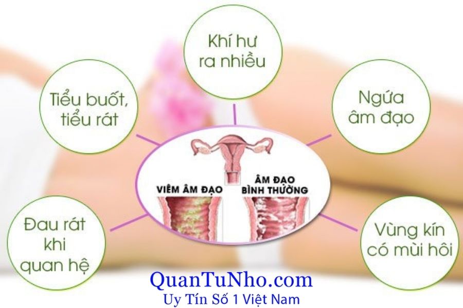 Rủi ro khi quan hệ ngày đèn đỏ