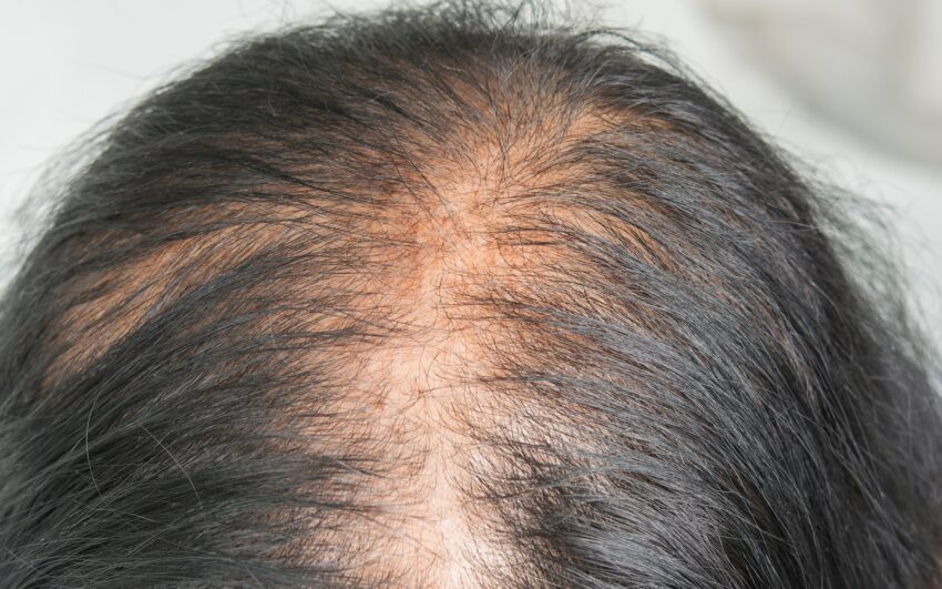 Da Và Tóc Thay Đổi Khác Lạ