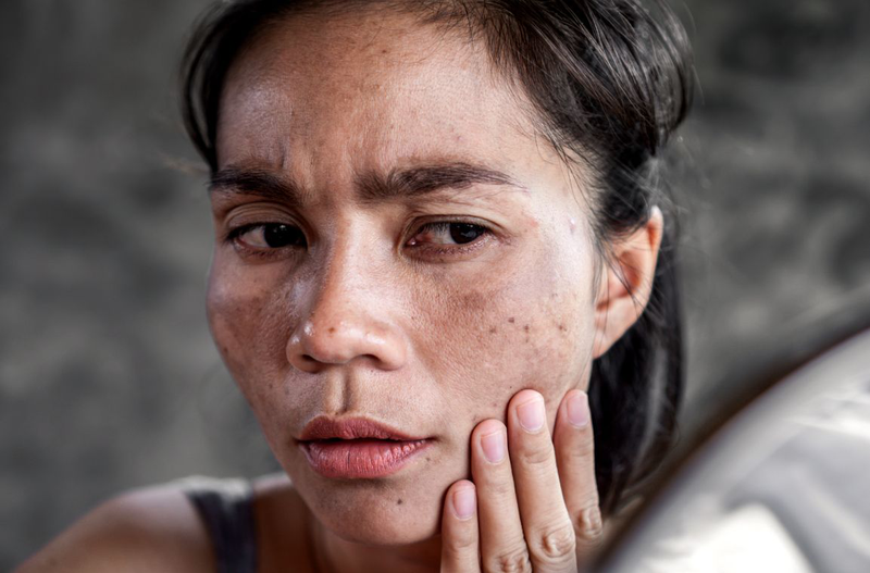 Thay đổi làn da và mái tóc khi mang thai