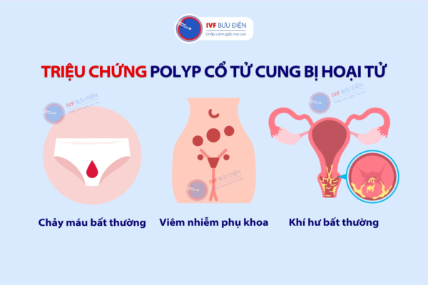 viêm cổ tử cung