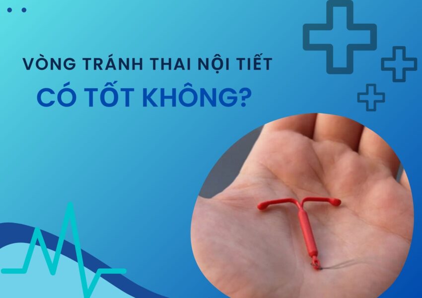 đặt vòng tránh thai có an toàn không