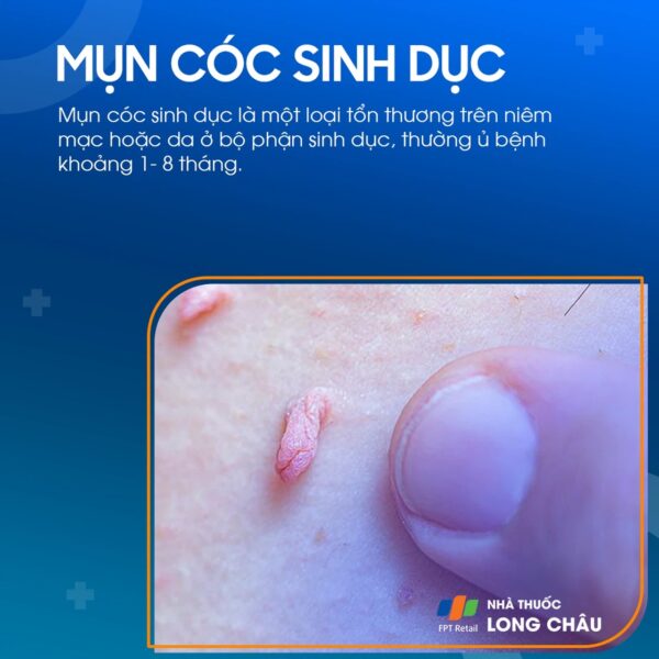 mụn cóc sinh dục ở nam