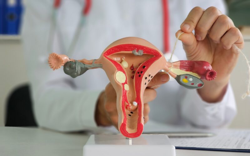 Chi phí thắt ống dẫn trứng khi sinh mổ: Phân tích, Yếu tố ảnh hưởng, Lợi ích và Rủi ro 2 Salpingectomy