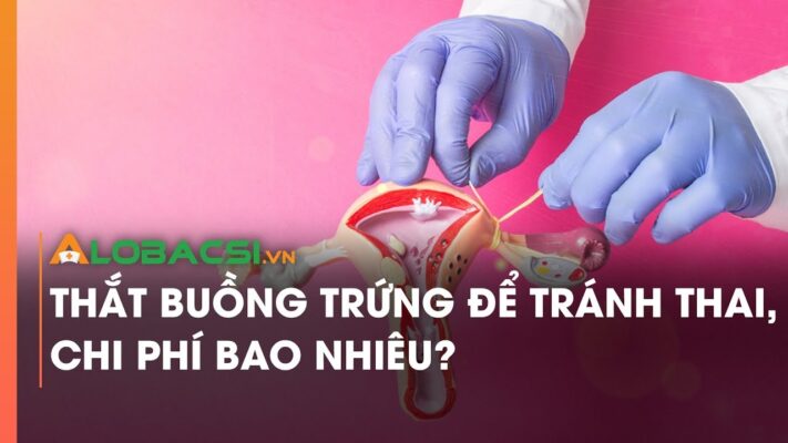 Chi Phí Thắt Ống Dẫn Trứng Khi Sinh Mổ