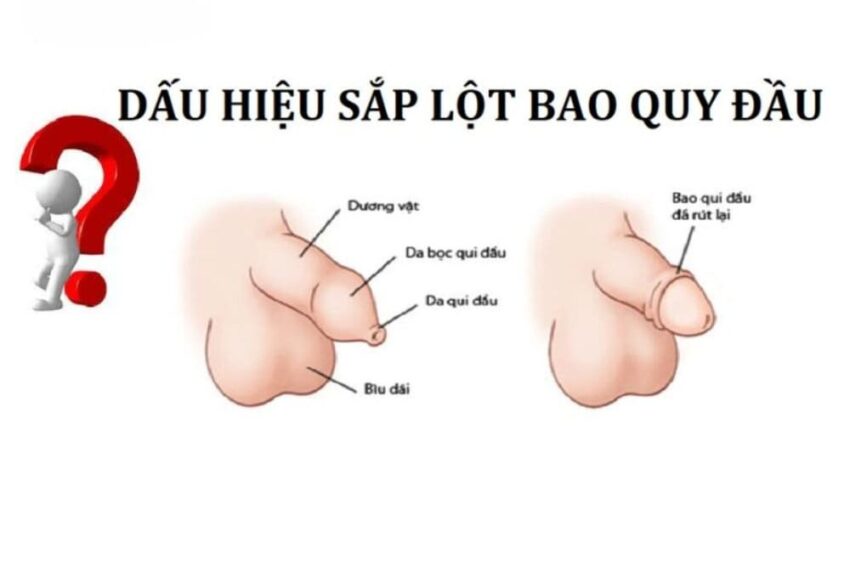 Các Dấu Hiệu Sắp Lột Bao Quy Đầu