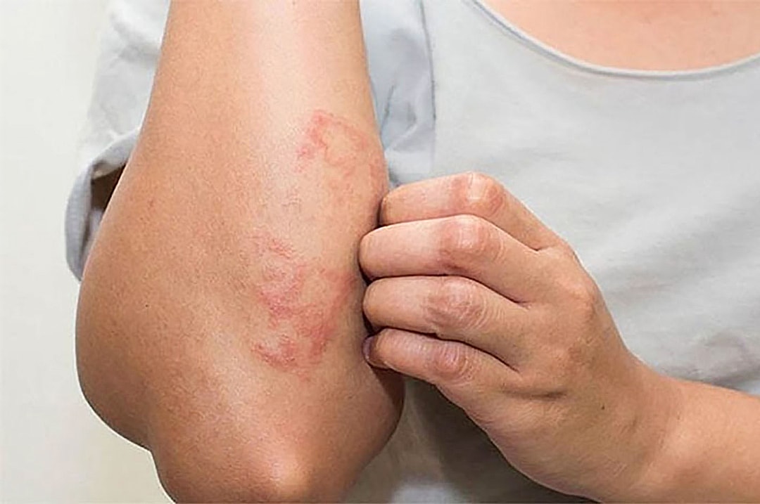 Nước hoa kích dục nữ không mùi: Định nghĩa, Cơ chế hoạt động, Phân loại và Lưu ý an toàn 6 di ung hai san