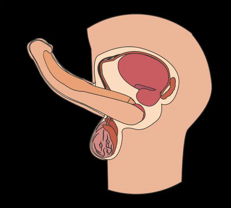 Tác Hại Của Gắn Bi: Rủi Ro, Biến Chứng, Ảnh Hưởng và Lời Khuyên Y Khoa 3 Cong vẹo dương vật