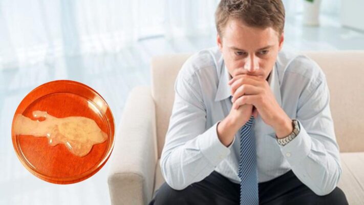 Hướng Dẫn Cách Khắc Phục Tinh Dịch Vón Cục