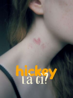 Hickey là gì