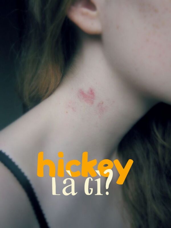 Hickey là gì