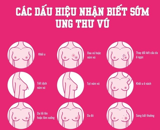 Ung Thư Vú Dạng Viêm