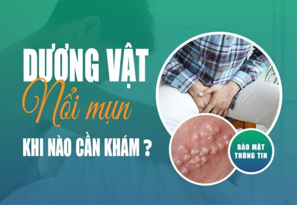 mụn thịt ở dương vật
