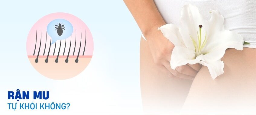 rận mu có tự hết không