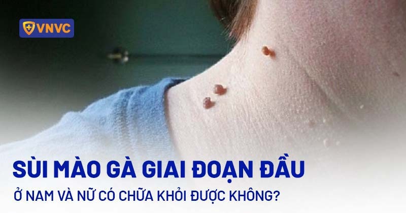 Giai đoạn đầu của sùi mào gà