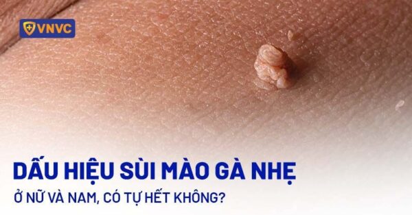 Nhận Diện Kẻ Thù