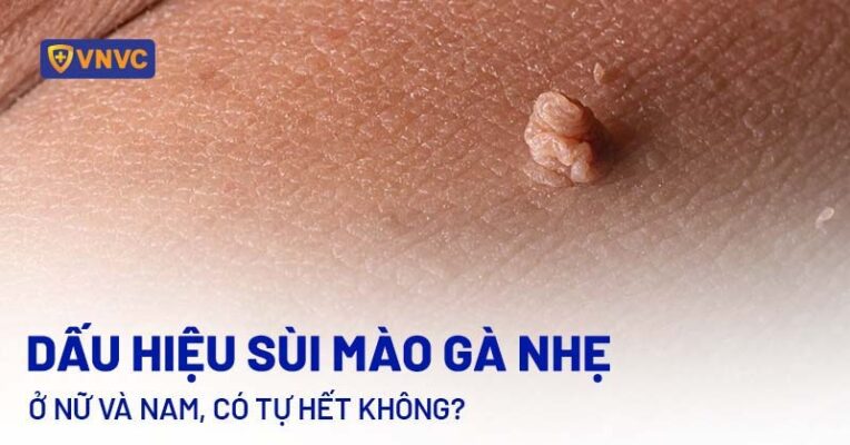 Nhận Diện Kẻ Thù