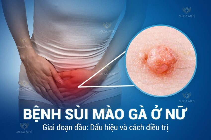 Triệu chứng sùi mào gà ở nữ giới