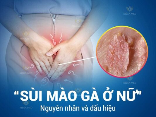 bệnh sùi mào gà ở nữ