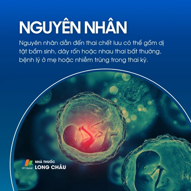 Những Nguyên Nhân Khiến Thai Chết Lưu